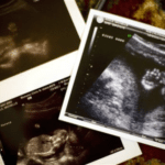 Alternative facts! ‘Atlantic’ retracts story claiming fetuses don’t have heartbeats